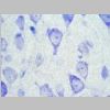 Neuronas Nissl 15.jpg